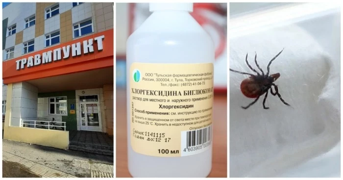 Что делать, если обнаружили под кожей клеща после похода в лес