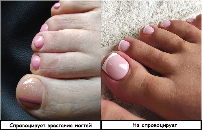 8 советов от мастеров педикюра, которые помогут добиться идеальных ножек даже в домашних условиях