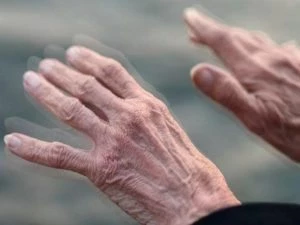 Танцуют все! Зачем пациентам с болезнью Паркинсона танго